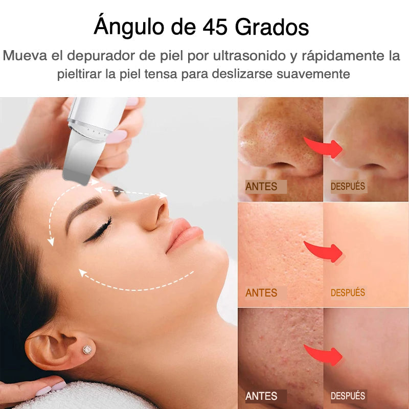 DermaVibra - Exfoliador Ultrasónico para una Piel Radiante